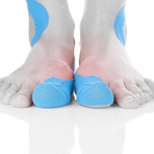 Funktionstaping an den Füßen